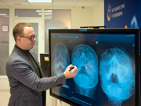 В Москве нейросети впервые начали распознавать признаки лор-заболеваний на рентгеновских снимках: утверждается, что система искусственного интеллекта (ИИ) способна обнаруживать синусит на рентгенографиях носовых пазух, сообщает Центр диагностики и те...